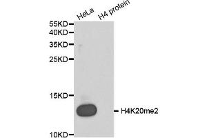 Western blot analysis of extracts of various cell lines, using Dimethyl-Histone H4-K20 antibody (ABIN5969818). (Histone H4 antibody  (2meLys20))