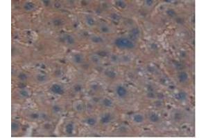 Immunohistochemistry (IHC) image for anti-Membrane Protein, Palmitoylated 6 (MAGUK P55 Subfamily Member 6) (MPP6) (AA 331-503) antibody (ABIN7432430)