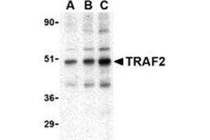 Western blot analysis of TRAF2 in mouse liver tissue lysate with this product at (A) 0.