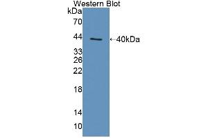 Western blot analysis of the recombinant protein. (TAP1 antibody  (AA 525-808))