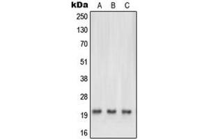 Western blot analysis of NRAS/HRAS/KRAS expression in HEK293T (A), HeLa (B), mouse brain (C), rat heart (D) whole cell lysates.