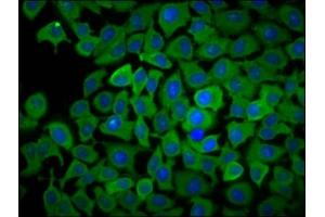 Immunofluorescence staining of A549 cells with ABIN7163387 at 1:166, counter-stained with DAPI. (PPCDC antibody  (AA 51-183))