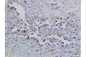 Formalin-fixed and paraffin embedded mouse lymphoma labeled with Anti-Oct-3/Oct-4 Polyclonal Antibody, Unconjugated (ABIN737826) at 1:200 followed by conjugation to the secondary antibody and DAB staining. (OCT4 antibody  (AA 201-300))