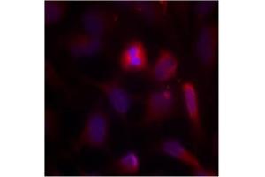 Image no. 2 for anti-Mitogen-Activated Protein Kinase Kinase Kinase 5 (MAP3K5) (Ser966) antibody (ABIN197327) (ASK1 antibody  (Ser966))