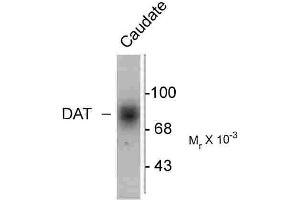 Western blots of human caudate lysate showing specific immunolabeling of the ~88k DAT protein. (SLC6A3 antibody  (C-Term))