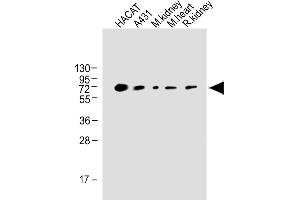 All lanes : Anti-OTOP1 Antibody (Center) at 1:1000 dilution Lane 1: HACAT whole cell lysate Lane 2: A431 whole tissue lysate Lane 3: Mouse kidney whole tissue lysate Lane 4: Mouse heart whole tissue lysate Lane 5: Rat kidney whole cell lysate Lane Lysates/proteins at 20 μg per lane. (Otopetrin 1 antibody  (AA 360-388))