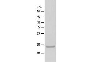 Western Blotting (WB) image for Mitochondrial Ribosomal Protein L2 (MRPL2) (AA 84-202) protein (His tag) (ABIN7123980) (MRPL2 Protein (AA 84-202) (His tag))
