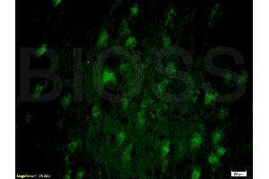 Formalin-fixed and paraffin-embedded rat brain labeled with Anti-SNAP25 Polyclonal Antibody, Unconjugated (ABIN738111) 1:200, overnight at 4°C, The secondary antibody was Goat Anti-Rabbit IgG, FiTC conjugated used at 1:200 dilution for 40 minutes at 37°C. (SNAP25 antibody  (AA 166-206))