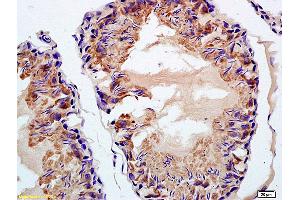 Formalin-fixed and paraffin embedded rat testis labeled with Rabbit Anti Phospho-BAP1(Ser592) Polyclonal Antibody, Unconjugated (ABIN683413) at 1:200 followed by conjugation to the secondary antibody and DAB staining (BAP1 antibody  (pSer592))