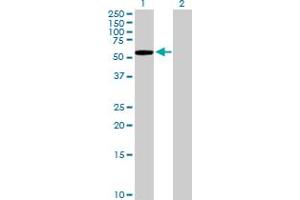 Western Blot analysis of KLHL7 expression in transfected 293T cell line by KLHL7 MaxPab polyclonal antibody.