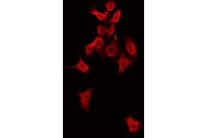 ABIN6274483 staining COLO205 by IF/ICC. (ALPK1 antibody  (Internal Region))