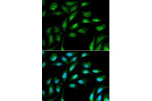 Immunofluorescence analysis of MCF-7 cells using B2M antibody. (beta-2 Microglobulin antibody  (AA 21-119))