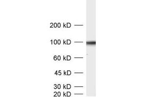 dilution: 1 : 1000, sample: crude synaptic vesicle fraction of rat brain (LP2) (SV2B antibody  (AA 2-17))