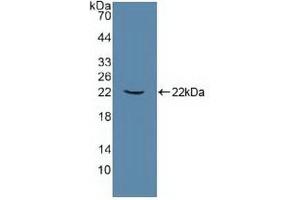 Detection of Recombinant ATP1a1, Human using Polyclonal Antibody to ATPase, Na+/K+ Transporting Alpha 1 Polypeptide (ATP1a1) (ATP1A1 antibody  (AA 493-660))