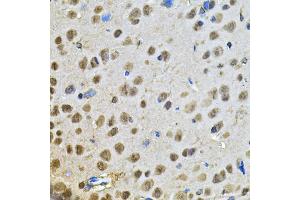 Immunohistochemistry of paraffin-embedded rat brain using PPID Antibody (ABIN5974177) at dilution of 1/100 (40x lens). (PPID antibody)