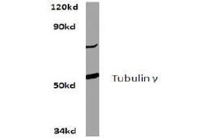 Image no. 2 for anti-Tubulin, gamma 1 (TUBG1) antibody (ABIN271969) (TUBG1 antibody)