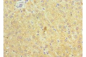 Immunohistochemistry of paraffin-embedded human liver tissue using ABIN7148555 at dilution of 1:100 (ATP7B antibody  (AA 1166-1465))