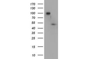 Western Blotting (WB) image for anti-Docking Protein 7 (DOK7) antibody (ABIN1497885)