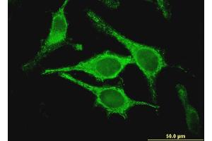 Immunofluorescence of monoclonal antibody to CLIC5 on HeLa cell. (CLIC5 antibody  (AA 91-190))