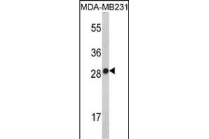 Western blot analysis of IL2 Antibody (Center) (ABIN390899 and ABIN2841106) in MDA-M cell line lysates (35 μg/lane). (IL-2 antibody  (AA 50-77))