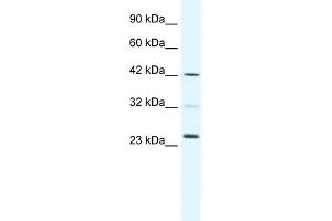 WB Suggested Anti-E2F1 Antibody Titration:  0. (E2F1 antibody  (C-Term))
