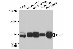 Western blot analysis of extracts of various cell lines, using XPOT antibody. (XPOT antibody  (AA 1-200))
