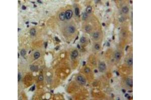 Used in DAB staining on fromalin fixed paraffin-embedded Liver tissue (IL-10 antibody  (AA 1-178))