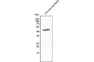 Western Blotting (WB) image for anti-mAmetrine Fluorescent Protein antibody (ABIN7273095) (mAmetrine Fluorescent Protein antibody)