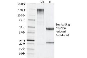 SDS-PAGE Analysis of Purified, BSA-Free TDP2 Antibody (clone TDP2/1258).