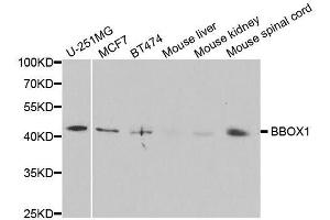 Western blot analysis of extracts of various cell lines, using BBOX1 antibody. (BBOX1 antibody  (AA 1-180))