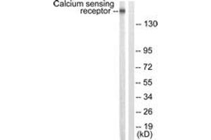 Western blot analysis of extracts from LOVO cells, using Calcium Sensing Receptor (Ab-888) Antibody.
