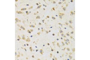 Immunohistochemistry of paraffin-embedded rat brain using RPS12 antibody (ABIN5973491) at dilution of 1/100 (40x lens). (RPS12 antibody)