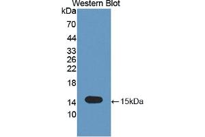 Figure. (TNFRSF19 antibody  (AA 61-163))