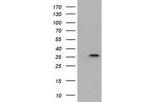 Western Blotting (WB) image for anti-Deoxynucleotidyltransferase, Terminal, Interacting Protein 1 (DNTTIP1) antibody (ABIN1497876)