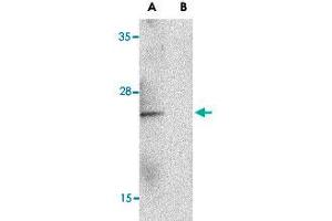 Western blot analysis of IL23A in Raji lysate with IL23A polyclonal antibody  at 1 ug/mL in the (A) absence and (B) presence of blocking peptide. (IL23A antibody  (C-Term))