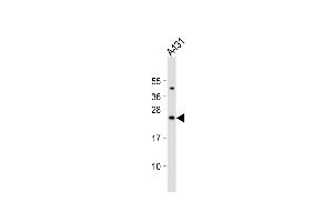 Western blot analysis of anti-Bad Antibody (Center) (ABIN388109 and ABIN2846236) in HL60 cell line lysates (35 μg/lane). (BAD antibody  (AA 53-81))
