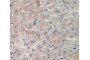 IHC-P analysis of Human Tissue, with DAB staining. (MPST antibody  (AA 68-278))