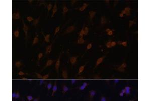Immunofluorescence analysis of C6 cells using POR Polyclonal Antibody at dilution of 1:100 (40x lens). (POR antibody)