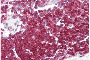 Image no. 2 for anti-Septin 9 (SEPT9) (C-Term) antibody (ABIN6749752) (Septin 9 antibody  (C-Term))