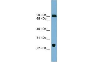 WB Suggested Anti-VPS53 Antibody Titration: 0. (VPS53 antibody  (Middle Region))