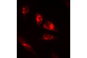 Immunofluorescent analysis of OCT2 staining in HeLa cells. (Oct-2 antibody  (N-Term))