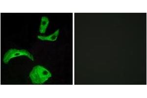 Immunofluorescence analysis of HeLa cells, using GPR18 Antibody. (GPR18 antibody  (AA 131-180))