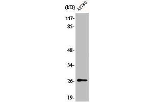 Western Blot analysis of COLO205 cells using Phospho-p27 (S10) Polyclonal Antibody (CDKN1B antibody  (pSer10))