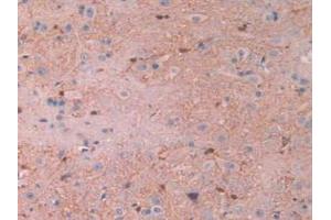 IHC-P analysis of Rat Spinal Cord Tissue, with DAB staining. (CAPNL1 antibody  (AA 387-694))