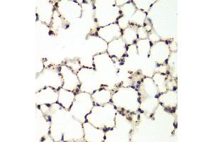 Immunohistochemistry of paraffin-embedded mouse lung using MAPK9 antibody at dilution of 1:200 (400x lens). (JNK2 antibody)