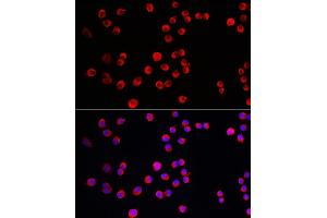 Immunofluorescence analysis of Neuro-2a cells using PTPN5 Rabbit pAb (ABIN7269705) at dilution of 1:150 (40x lens). (PTPN5 antibody  (AA 360-490))