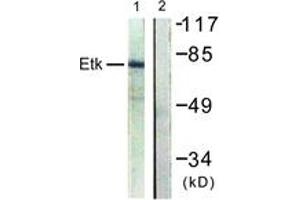 Western blot analysis of extracts from HepG2 cells, using ETK (Ab-40) Antibody. (BMX antibody  (AA 6-55))