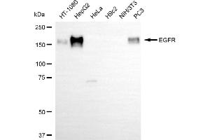 Western blotting analysis using EGFR antibody (ABIN7798460). (EGFR antibody)