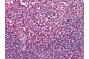 Immunohistochemical analysis of paraffin-embedded human Tonsil tissues using anti-CD80 antibody (CD80 antibody)