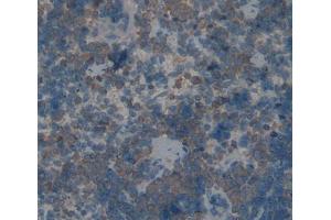 IHC-P analysis of spleen tissue, with DAB staining. (TLR1 antibody  (AA 25-134))